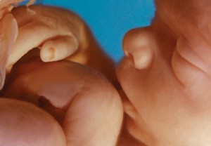 unborn-human-fetus