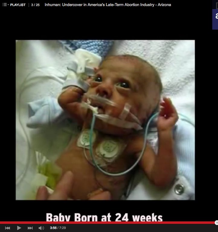 preemie, abortionist