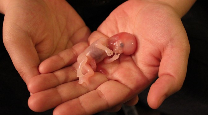 Miscarried At 12 Weeks Baby Noah Is Changing Minds About Abortion