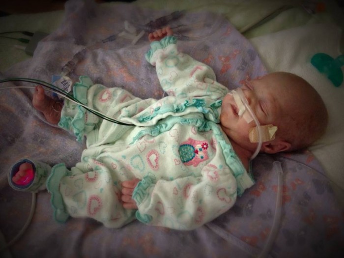 Miracle Baby, Born Premature At 25 Weeks, Is Beating The Odds