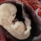heart, embryo, heartbeat abortion bill, embryo, science