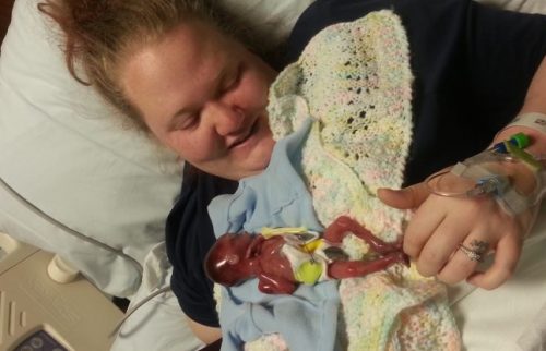 Mother Shares Powerful Photos Of Baby Miscarried At 20 Weeks He Was