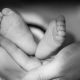 anencephaly, feet,