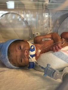 My miracle baby Malachi was born premature at 25 weeks