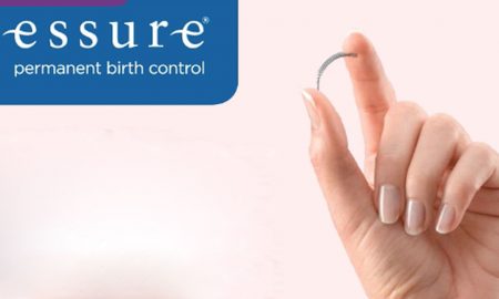 Essure, birth control, contraceptives