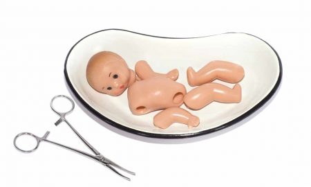 dismemberment abortion