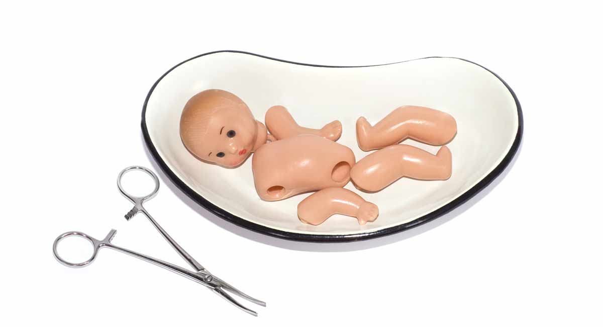 dismemberment abortion