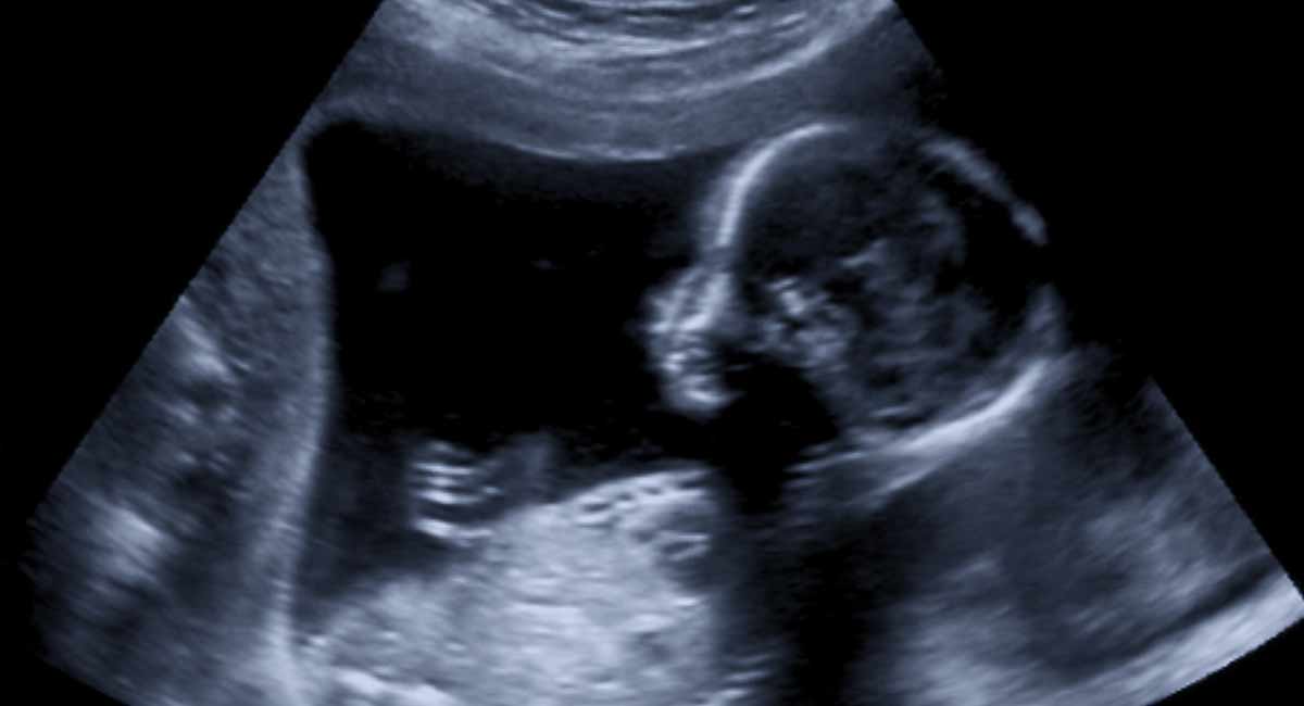 abortion, disability, ultrasound
