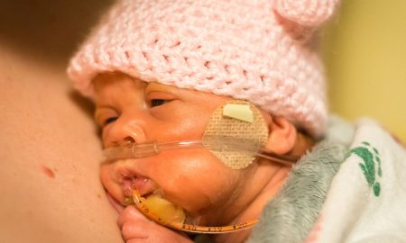 preemie, born alive