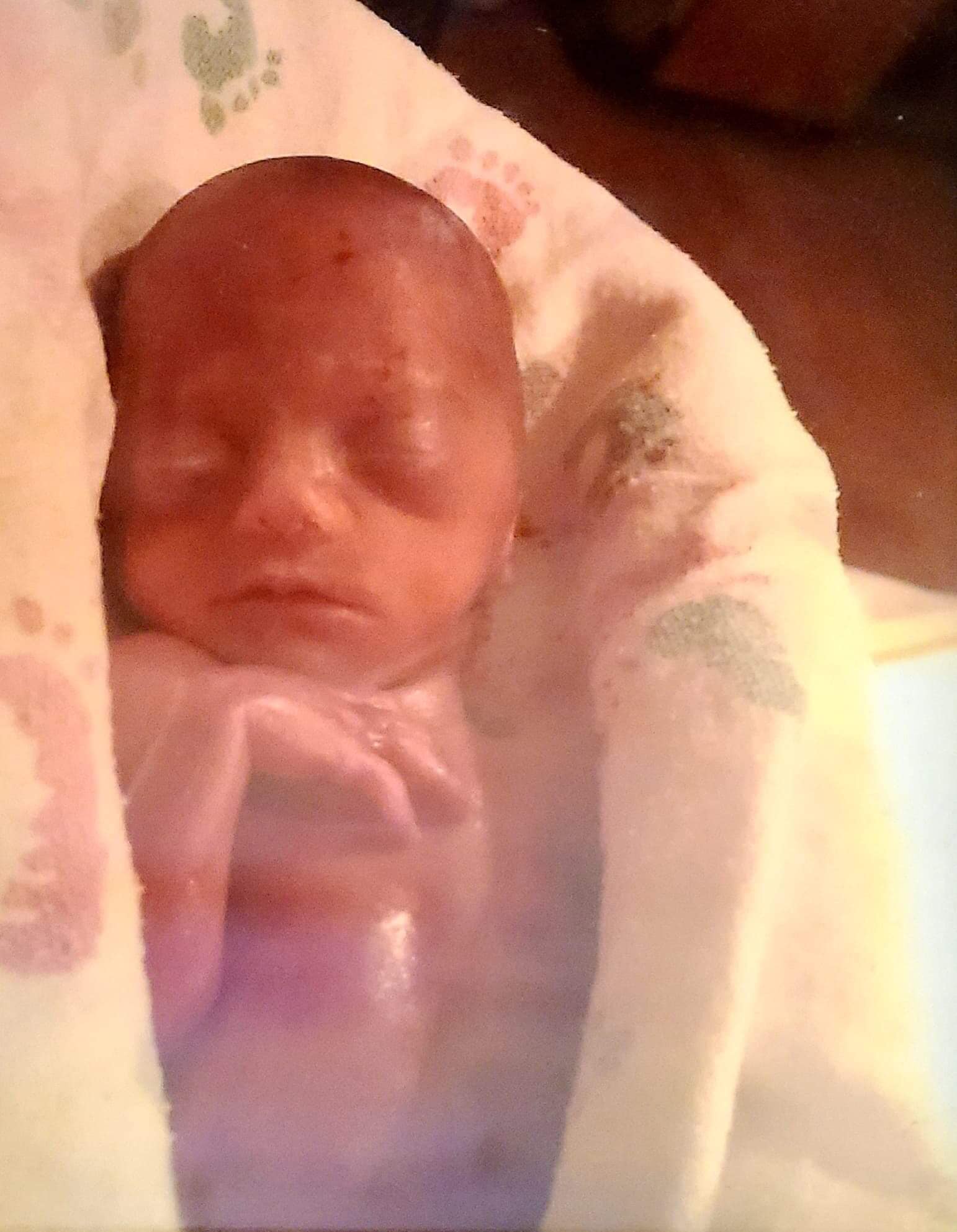 Heartbroken Mom Of Baby Born At 22 Weeks To The Doctors She Wasn t A 