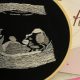 embroidered ultrasound