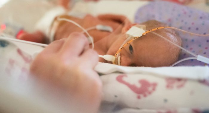 preemie, premature birth, pacemaker, premature