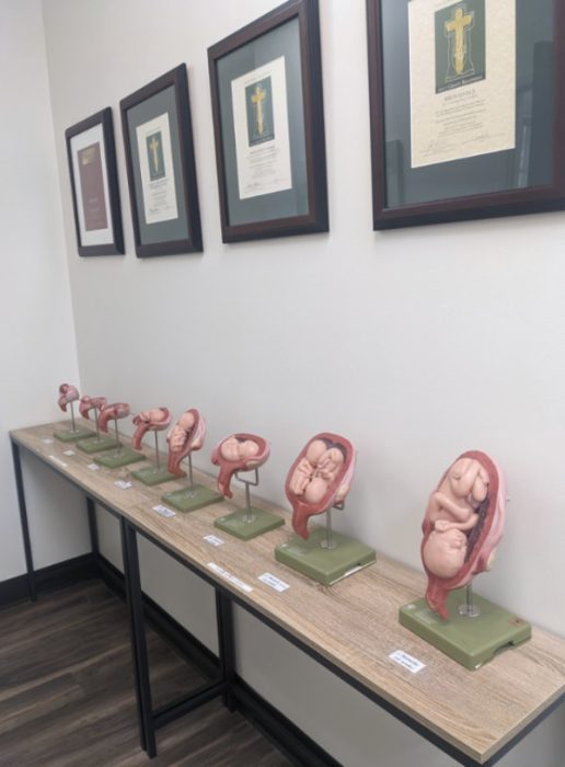 Fetal models at Birth Choice in Dallas