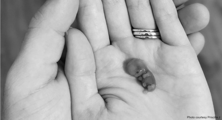 stunning-photo-of-noah-miscarried-at-12-weeks-shows-life-in-the-womb