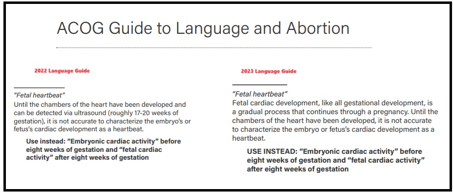ACOG fetal heartbeat info in Language Guide to Abortion changed 2022-23