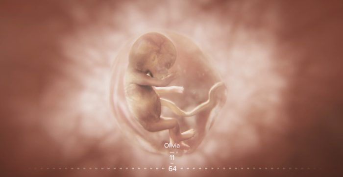 Iowa, Baby Olivia, prenatal development