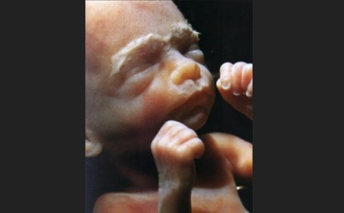 Abortionist discusses the grief of choosing to have her own child killed at 23 weeks